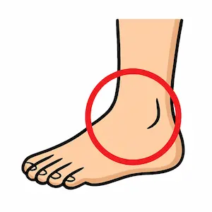 Ankle ข้อเท้า