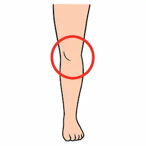 Knee หัวเข่า